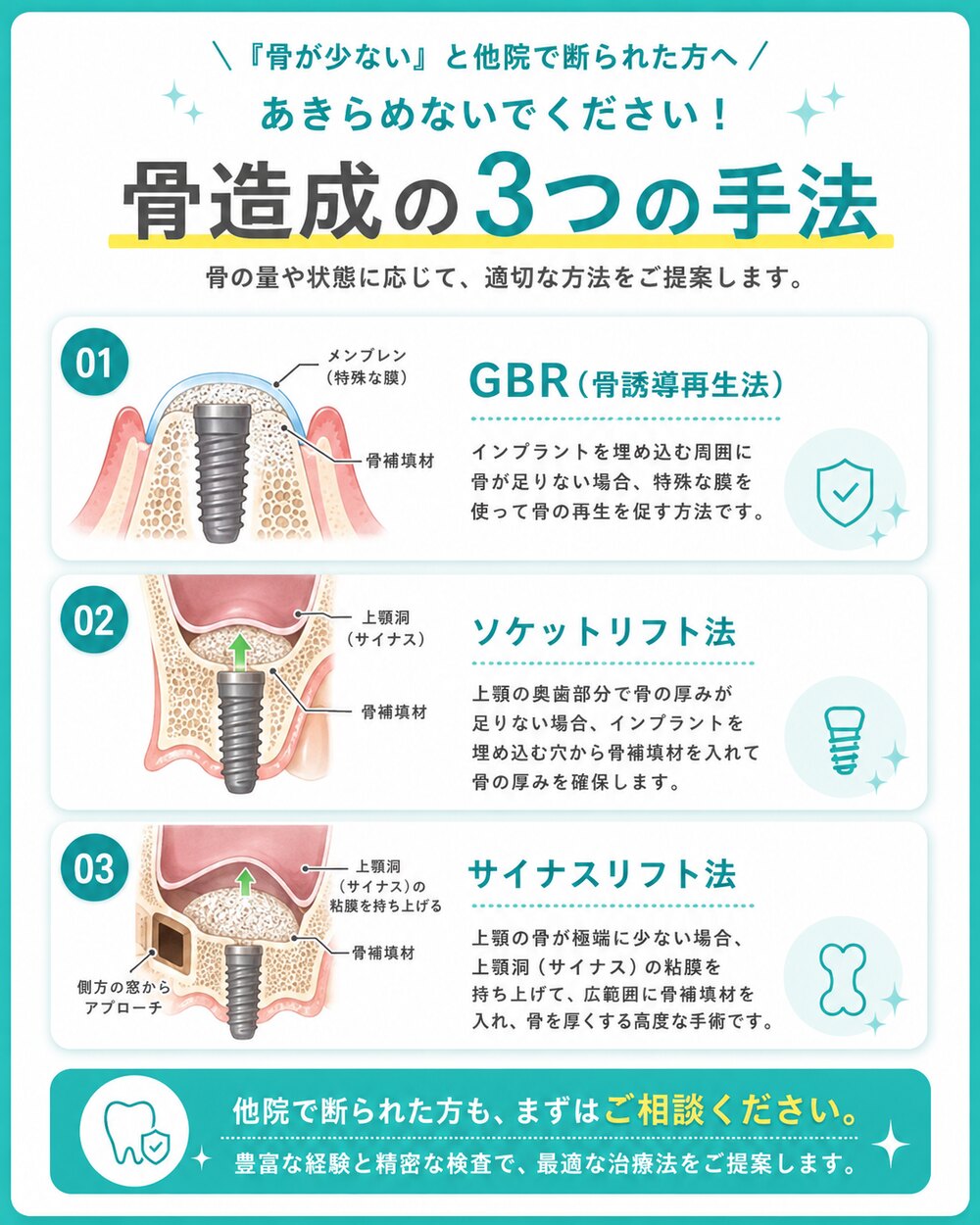 「骨が少ない」と他院で断られた方へ。あきらめないでください。骨造成の3つの手法：GBR（骨誘導再生法）は特殊な膜を使って骨の再生を促す方法。ソケットリフト法はインプラントを埋め込む穴から骨補填材を入れて厚みを確保。サイナスリフト法は上顎洞の粘膜を持ち上げ広範囲に骨補填材を入れる高度な手術。